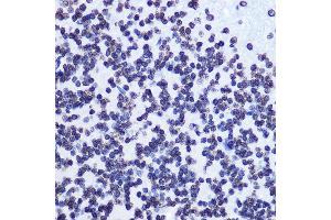 Immunohistochemistry of paraffin-embedded rat brain using Phospho-SMC1-S957 Rabbit mAb (ABIN7270613) at dilution of 1:100 (40x lens). (SMC1A anticorps  (pSer957))