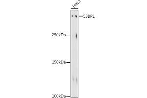 Western blot analysis of extracts of HeLa cells, using 53BP1 antibody (ABIN1679832, ABIN3018199, ABIN3018200 and ABIN7101582) at 1:500 dilution. (TP53BP1 anticorps)