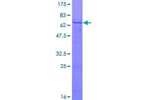 Image no. 1 for Platelet Derived Growth Factor D (PDGFD) (AA 1-364) protein (GST tag) (ABIN1314507)