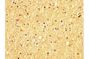 IHC image of ABIN7144013 diluted at 1:300 and staining in paraffin-embedded human brain tissue performed on a Leica BondTM system. (RHCG anticorps  (AA 416-479))