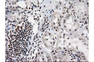 Immunohistochemical staining of paraffin-embedded Human Kidney tissue using anti-PRKCE mouse monoclonal antibody. (PKC epsilon anticorps)