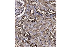 Immunohistochemical analysis of C on paraffin-embedded Human kidney tissue. (Cyclin Y anticorps  (AA 140-169))