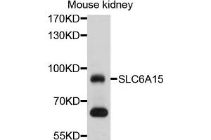 Western blot analysis of extracts of mouse kidney, using SLC6A15 antibody (ABIN4905212) at 1:1000 dilution. (SLC6A15 anticorps)