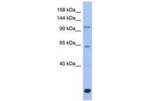 Image no. 1 for anti-BTB and CNC Homology 1, Basic Leucine Zipper Transcription Factor 2 (BACH2) (C-Term) antibody (ABIN6742357) (BACH2 anticorps  (C-Term))