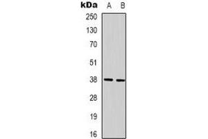 Western blot analysis of XRCC4 expression in Hela (A), 293T (B) whole cell lysates. (XRCC4 anticorps)
