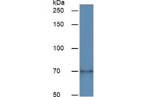 Rabbit Capture antibody from the kit in WB with Positive Control:  Human Lung lysate.