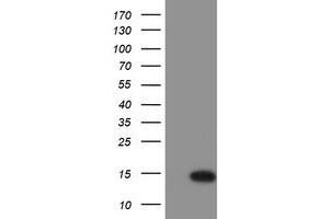 Western Blotting (WB) image for anti-Chromosome 17 Open Reading Frame 37 (C17orf37) antibody (ABIN1501778) (C17orf37 anticorps)