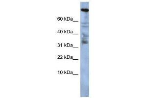 Western Blot showing ZNF251 antibody used at a concentration of 1-2 ug/ml to detect its target protein. (ZNF251 anticorps  (Middle Region))