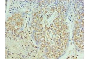Immunohistochemistry of paraffin-embedded human tonsil tissue using ABIN7168869 at dilution of 1:100 (Septin 6 anticorps  (AA 350-434))