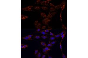 Immunofluorescence analysis of C6 cells using PFDN4 antibody (ABIN7269508) at dilution of 1:100.