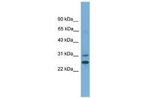 WB Suggested Anti-DHRS2  Antibody Titration: 0.