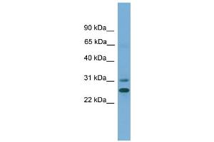WB Suggested Anti-DHRS2  Antibody Titration: 0. (DHRS2 anticorps  (N-Term))