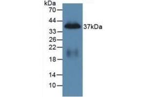 Detection of Recombinant PP, Mouse using Polyclonal Antibody to Pancreatic Polypeptide (PP) (PPY anticorps  (AA 31-97))