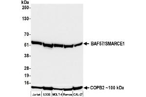 Western Blotting (WB) image for anti-SWI/SNF Related, Matrix Associated, Actin Dependent Regulator of Chromatin, Subfamily E, Member 1 (SMARCE1) (C-Term) antibody (ABIN7795731)
