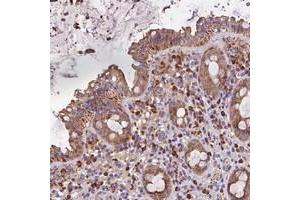 Immunohistochemical staining of human rectum with METTL22 polyclonal antibody  shows moderate cytoplasmic positivity in glandular cells. (METTL22 anticorps)