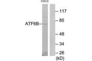 Western blot analysis of extracts from COLO205 cells, using ATF6B Antibody.