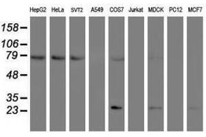 Image no. 1 for anti-Folate Hydrolase (Prostate-Specific Membrane Antigen) 1 (FOLH1) antibody (ABIN1500455) (PSMA anticorps)