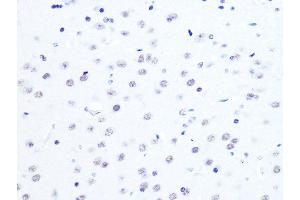 Immunohistochemistry of paraffin-embedded mouse brain using L Rabbit mAb (ABIN7270266) at dilution of 1:100 (40x lens).