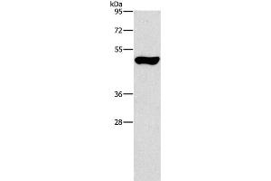 Western Blot analysis of Mouse pancreas tissue using ILK Polyclonal Antibody at dilution of 1:550 (ILK anticorps)