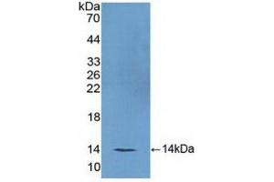 Detection of Recombinant FSH, Mouse using Polyclonal Antibody to Follicle Stimulating Hormone (FSH) (FSH anticorps  (AA 25-120))