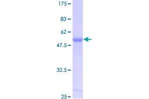 Image no. 1 for Peroxiredoxin 6 (PRDX6) (AA 1-224) protein (GST tag) (ABIN1316165)