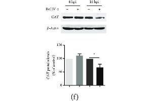 The effects of BoHV-1 infection on the gene expression of antioxidant enzymes. (Catalase anticorps  (AA 1-225))