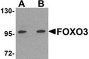 Western blot analysis of FOXO3 in A-20 cell lysate with FOXO3 antibody at (A) 0. (FOXO3 anticorps  (N-Term))