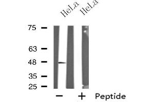 Western blot analysis of extracts from HeLa cells, using GPR19 antibody. (GPR19 anticorps  (C-Term))
