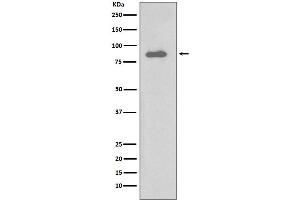 Western blot analysis of IKK alpha expression in Daudi cell lysate.