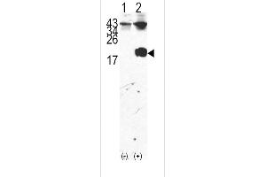Western blot analysis of FKBP12 (arrow) using rabbit polyclonal FKBP12 Antibody (Center) (ABIN392172 and ABIN2841886). (FKBP1A anticorps  (AA 43-74))