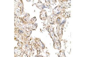 Immunohistochemistry of paraffin-embedded human placenta using TAZ Rabbit pAb (ABIN6130800, ABIN6150278, ABIN6150279 and ABIN6224227) at dilution of 1:50 (40x lens).
