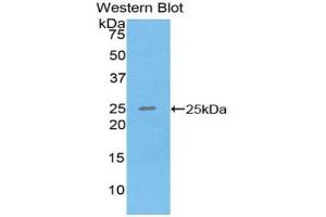 Western blot analysis of the recombinant protein. (SPRY3 anticorps  (AA 91-288))