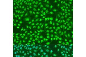Immunofluorescence analysis of U2OS cells using PSEN2 Polyclonal Antibody at dilution of 1:100. (Presenilin 2 anticorps)
