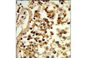 Formalin-fixed and paraffin-embedded human testis tissue reacted with IL31 Antibody (N-term), which was peroxidase-conjugated to the secondary antibody, followed by DAB staining.