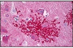 Human Brain, Astrocytes Microglia: Formalin-Fixed, Paraffin-Embedded (FFPE) (CXCR4 anticorps  (C-Term))