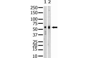 Western Blotting (WB) image for anti-SET Domain Containing (Lysine Methyltransferase) 8 (SETD8) antibody (ABIN2995295)