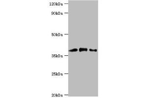 Western blot All lanes: Macrophage-capping protein antibody at 1 μg/mL Lane 1: Hela whole cell lysate Lane 2: NIH/3T3 whole cell lysate Lane 3: Rat lung tissue Secondary Goat polyclonal to rabbit IgG at 1/10000 dilution Predicted band size: 39, 37 kDa Observed band size: 39 kDa (CAPG anticorps  (AA 1-348))