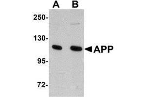 Western blot analysis of APP in rat brain tissue lysate with AP30073PU-N APP antibody at (A) 1 and (B) 2 μg/ml. (APP anticorps  (N-Term))
