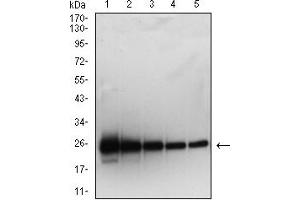 Western blot analysis using SARS-Cov2-NP2 mAb against human SARS-Cov2-N (AA: 120-300) recombinant protein. (SARS-Cov2-NP2 (AA 120-300) anticorps)