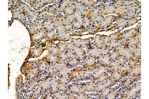ABIN7095615 and ABIN7099677 at 1/100 staining rat liver tissue by IHC-P.