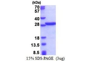 SDS-PAGE (SDS) image for Poly A Binding Protein Nuclear 1 (PABPN1) (AA 119-306) protein (His tag) (ABIN5853467)