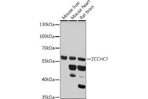 Western blot analysis of extracts of various cell lines, using ZCCHC7 antibody (ABIN7271547) at 1:1000 dilution. (ZCCHC7 anticorps)