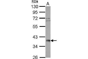 WB Image Sample (30 ug of whole cell lysate) A: HeLa nucleus 10% SDS PAGE antibody diluted at 1:1000