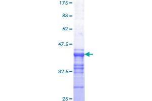Image no. 1 for V-Myb Myeloblastosis Viral Oncogene Homolog (Avian) (MYB) (AA 541-640) protein (GST tag) (ABIN1311699)