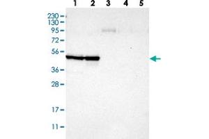 Western blot analysis of Lane 1: RT-4, Lane 2: U-251 MG, Lane 3: Human Plasma, Lane 4: Liver, Lane 5: Tonsil with CCNB2 polyclonal antibody  at 1:250-1:500 dilution.