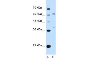 IL28R alpha antibody used at 1 ug/ml to detect target protein. (IL28RA anticorps)