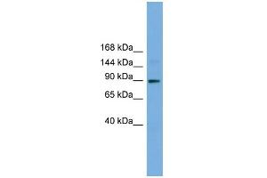 WB Suggested Anti-TTC27 Antibody Titration: 0. (TTC27 anticorps  (N-Term))