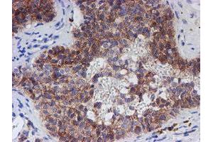 Image no. 5 for anti-Chromosome 21 Open Reading Frame 56 (C21orf56) antibody (ABIN1497041) (C21ORF56 anticorps)