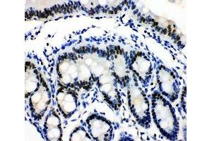 IHC-P: MCM3 antibody testing of rat intestine tissue (MCM3 anticorps  (N-Term))