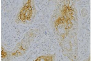 ABIN6276830 at 1/100 staining Human uterus tissue by IHC-P. (Complement Factor B anticorps  (Internal Region))